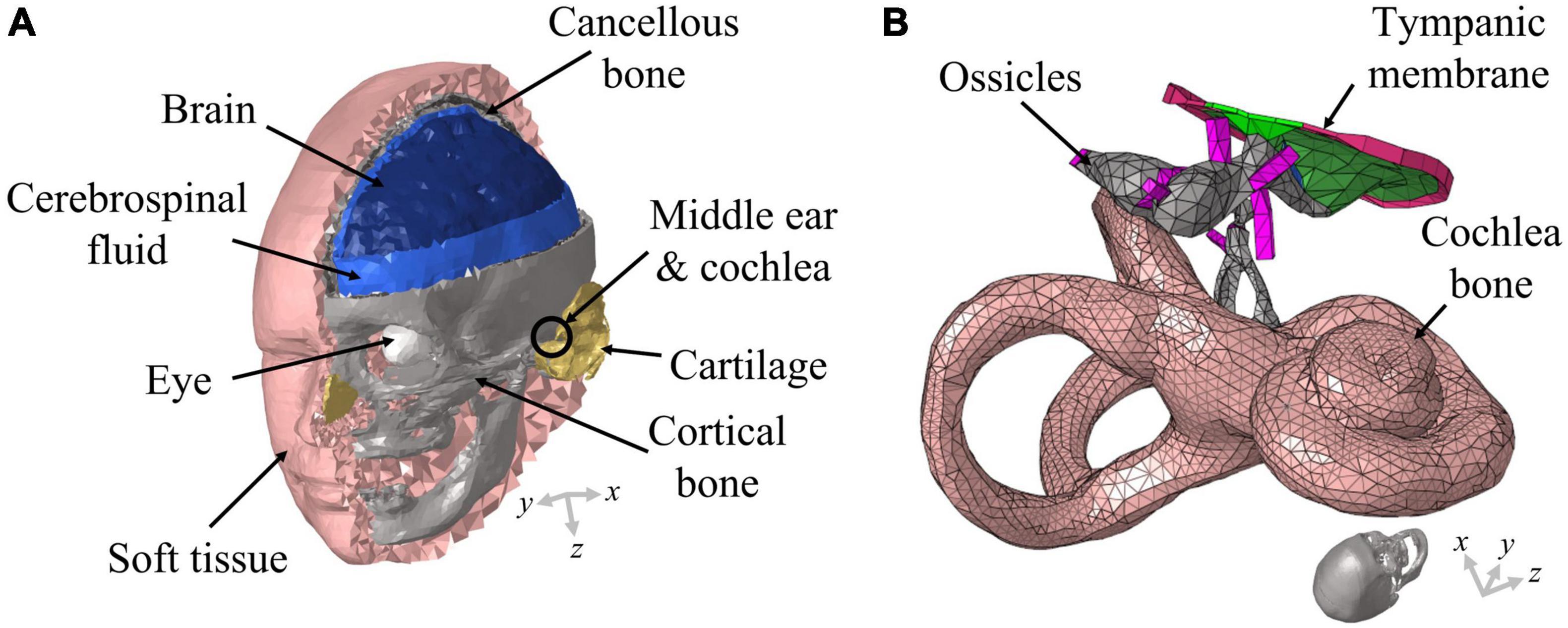 Effect of closing material on hearing rehabilitation in stapedectomy and stapedotomy: A finite element analysis